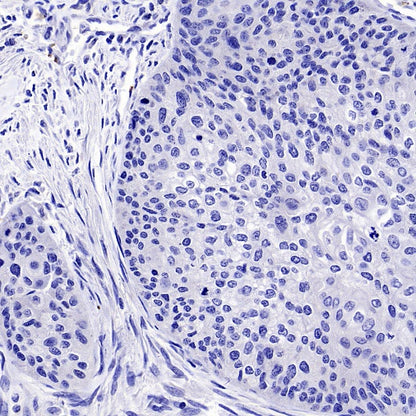SOX11 Recombinant Mouse mAb (SDT-919-58)