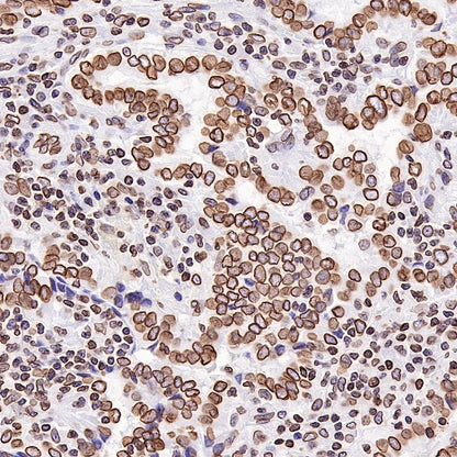 S-RMab®Lamin B2 Recombinant Rabbit mAb (S-951-70)