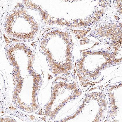 M6PR Recombinant Rabbit mAb (S-2348-14)