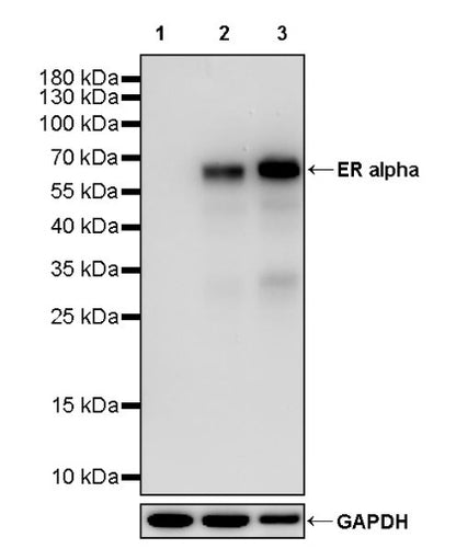 ER alpha Recombinant Rabbit mAb (SDT-2950-36)