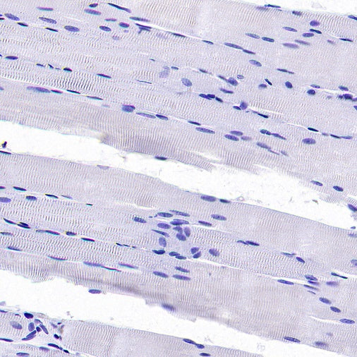 TROP1/EPCAM Recombinant Rabbit mAb (S-1379-5)