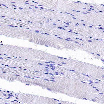 TROP1/EPCAM Recombinant Rabbit mAb (S-1379-5)