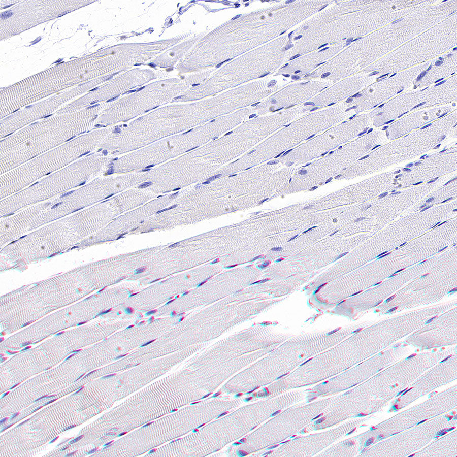 ATAD2 Recombinant Rabbit mAb (S-4145-63)