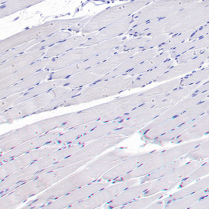 ATAD2 Recombinant Rabbit mAb (S-4145-63)