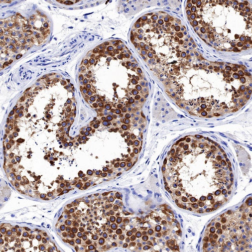 KIF3A Recombinant Rabbit mAb (S-1083-9)