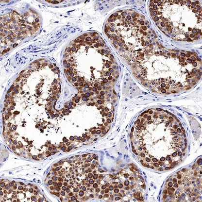 KIF3A Recombinant Rabbit mAb (S-1083-9)