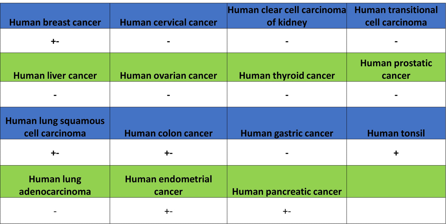 ITGB7 Recombinant Rabbit mAb (S-4138)
