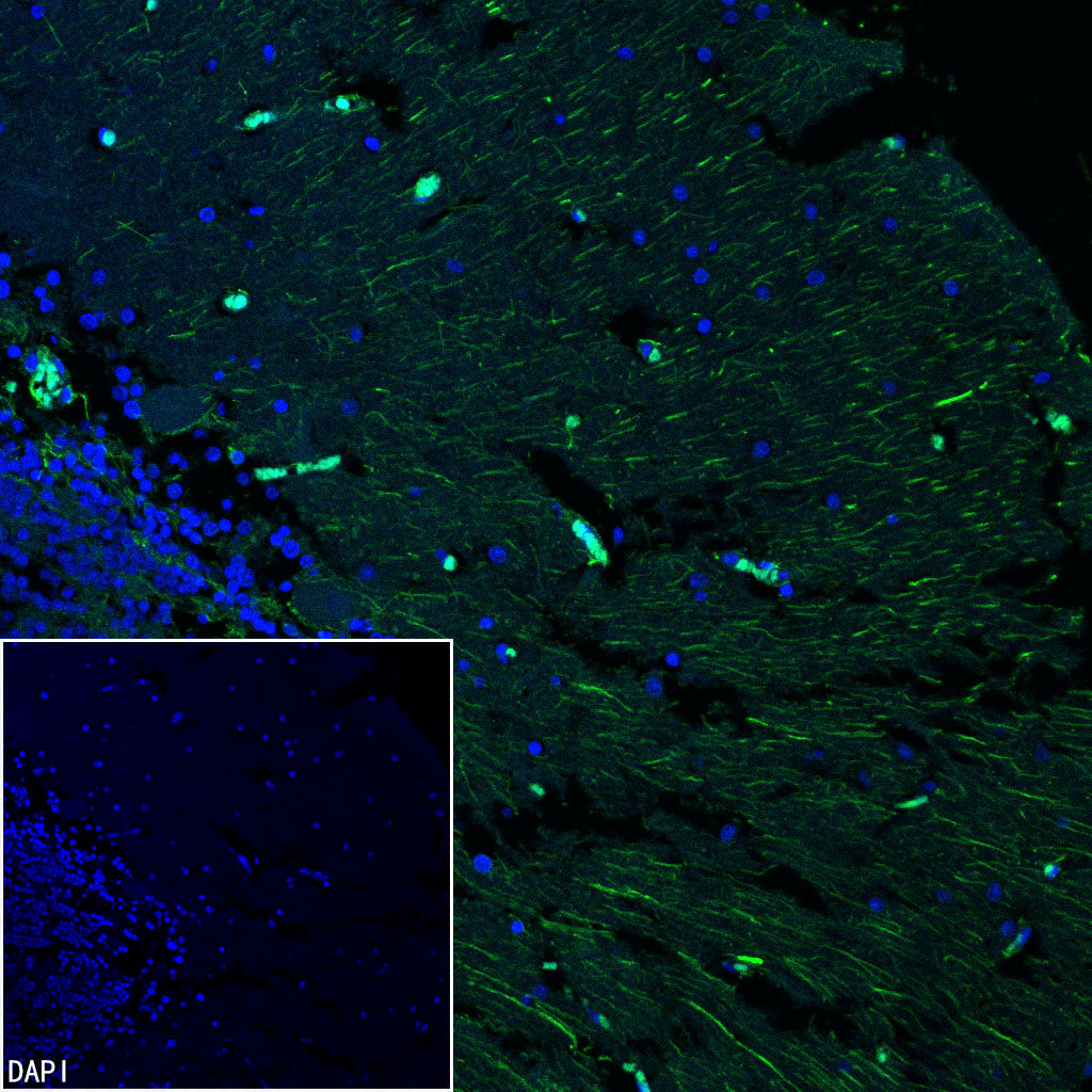 GFAP Recombinant Rabbit mAb (Alexa Fluor® 488 Conjugate) (SDT-306-10)