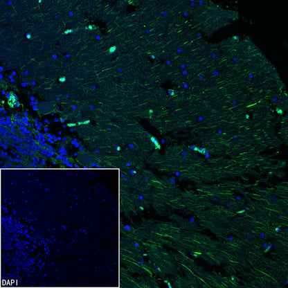 GFAP Recombinant Rabbit mAb (Alexa Fluor® 488 Conjugate) (SDT-306-10)