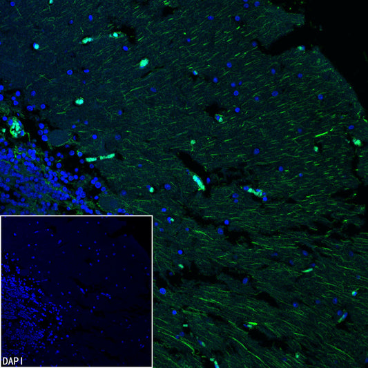 GFAP Recombinant Rabbit mAb (Alexa Fluor® 488 Conjugate) (SDT-306-10)