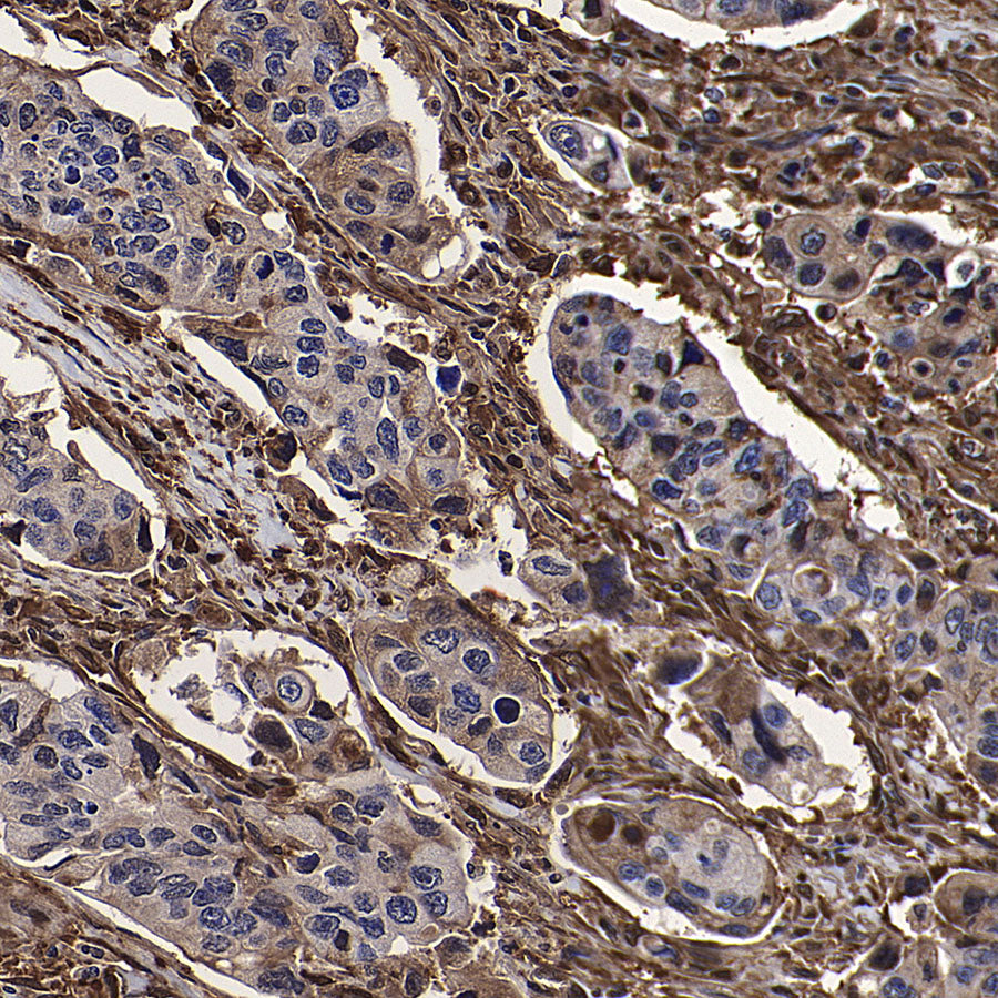 GBP2 Recombinant Rabbit mAb