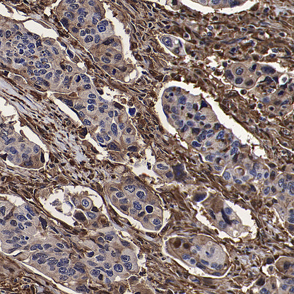 GBP2 Recombinant Rabbit mAb