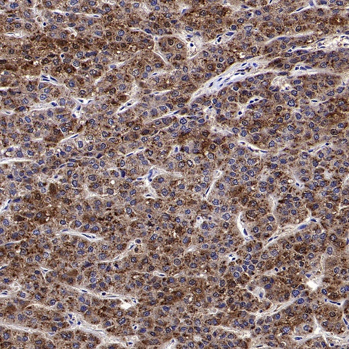 Catalase Recombinant Rabbit mAb (S-1925-3)