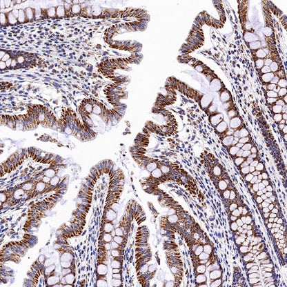 SDHB Recombinant Rabbit mAb (SDT-1162-2)