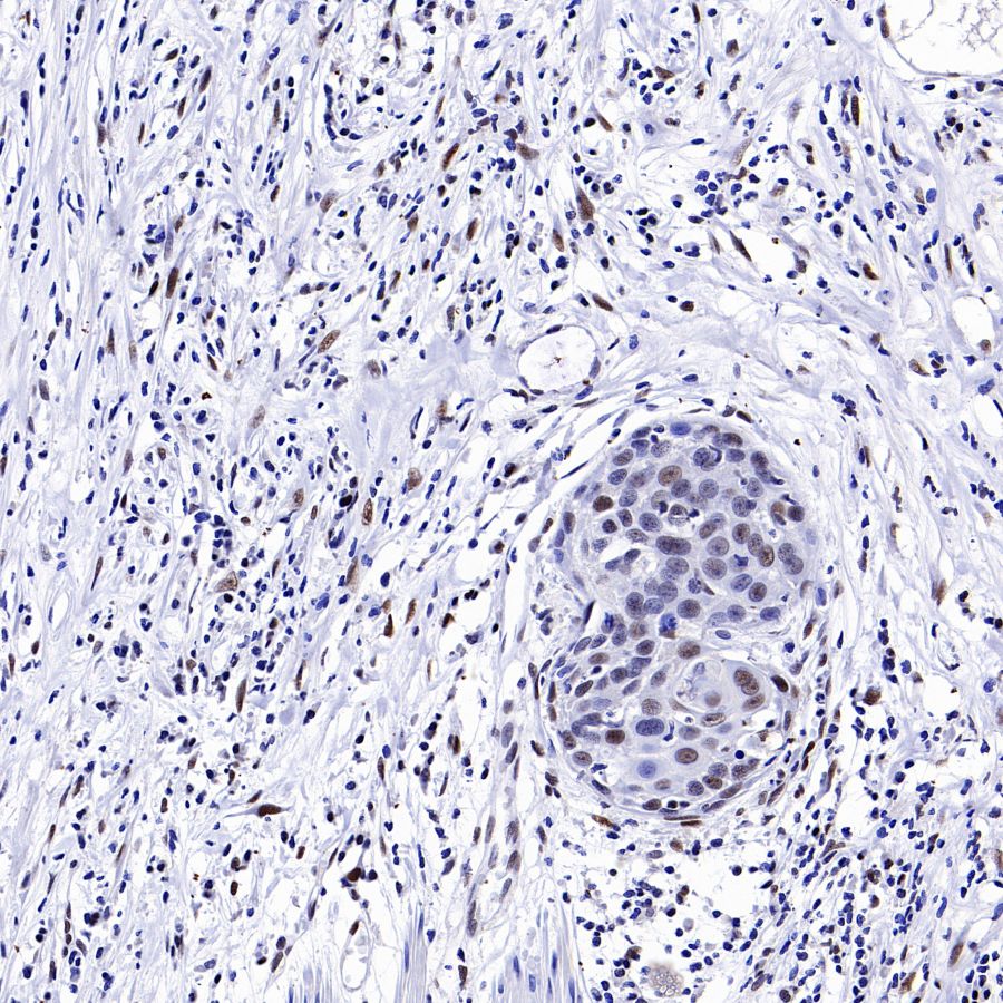 SLFN11 Recombinant Mouse mAb (S-1565-283)