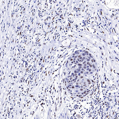 SLFN11 Recombinant Mouse mAb (S-1565-283)