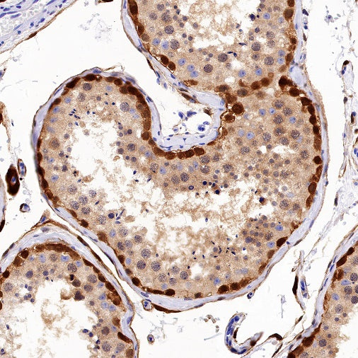 UCHL1 Recombinant Rabbit mAb (S-1765-38)