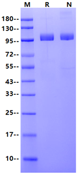 PSMA/FOLH1 His Tag Protein, Human