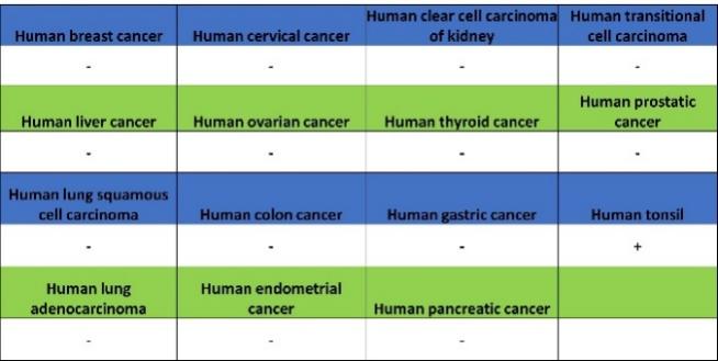 TBR2/Eomes Recombinant Rabbit mAb (SDT-1101-231)