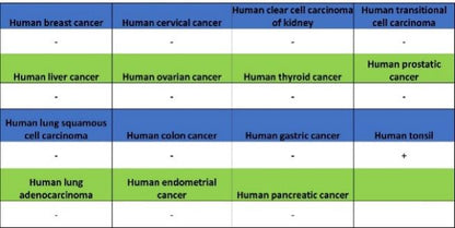 TBR2/Eomes Recombinant Rabbit mAb (SDT-1101-231)