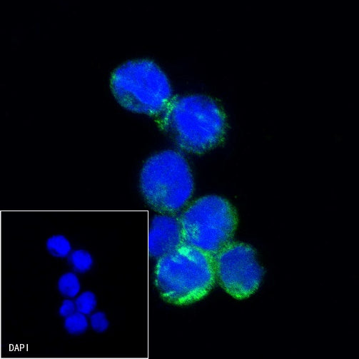 CHI3L1 Recombinant Rabbit mAb (S-324-38)