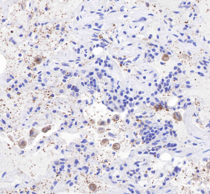 CD206 Recombinant Rabbit mAb(SDT-022-2)