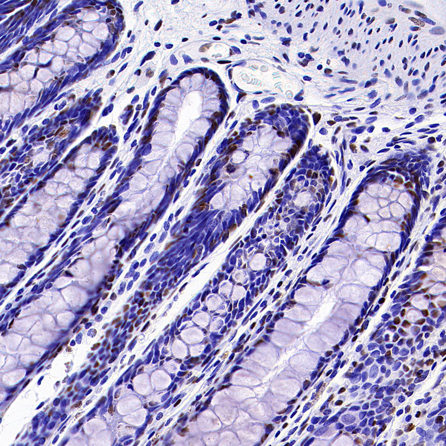 CDK11/CDC2L2/CDK11A Recombinant Rabbit mAb (S-3994-75)