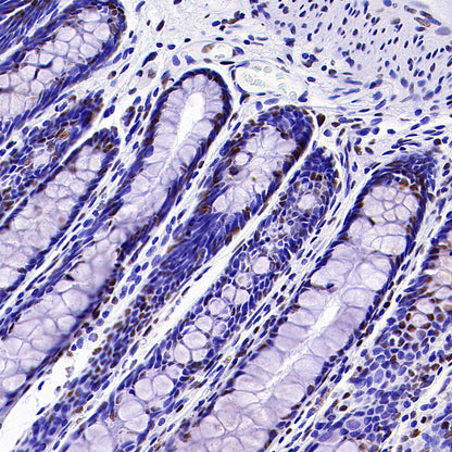 CDK11/CDC2L2/CDK11A Recombinant Rabbit mAb (S-3994-75)