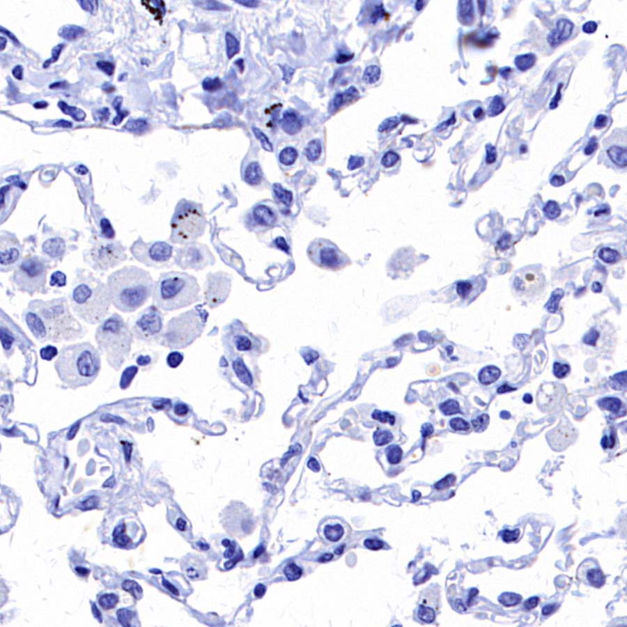 ALCAM Recombinant Rabbit mAb (S-4080-21)