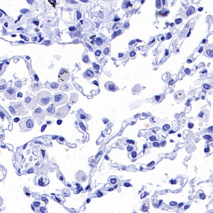 ALCAM Recombinant Rabbit mAb (S-4080-21)
