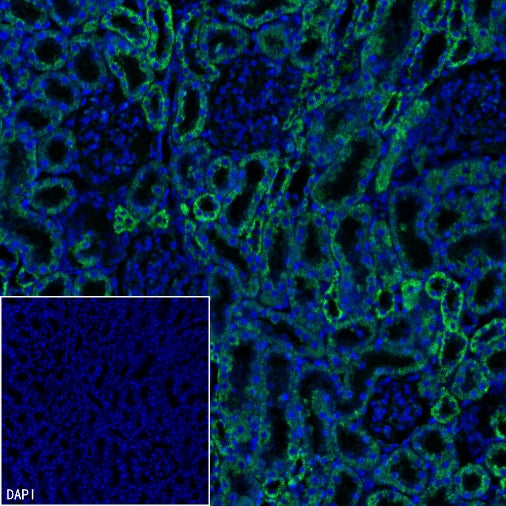 MTCO1 Recombinant Rabbit mAb (S-2205-28)