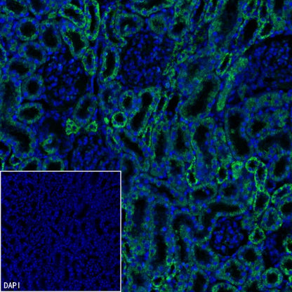 MTCO1 Recombinant Rabbit mAb (S-2205-28)