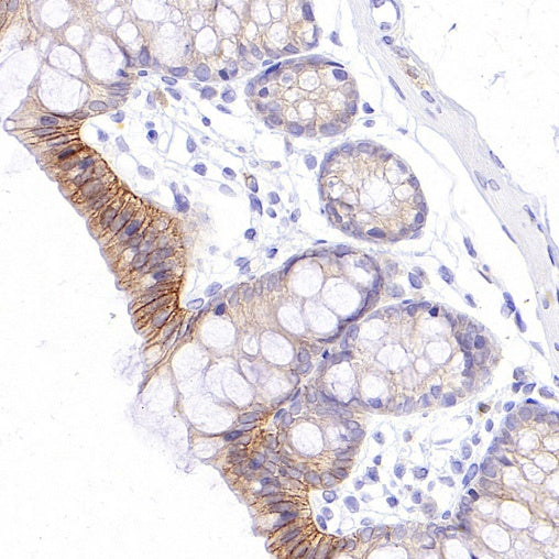 ErbB3 Recombinant Rabbit mAb (SDT-991-14)