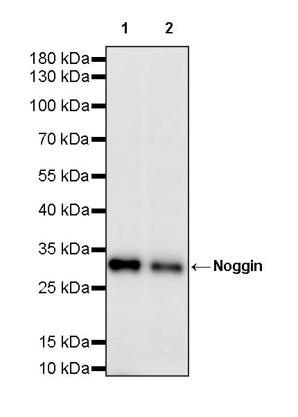 Noggin Recombinant Rabbit mAb (S-4030-12)