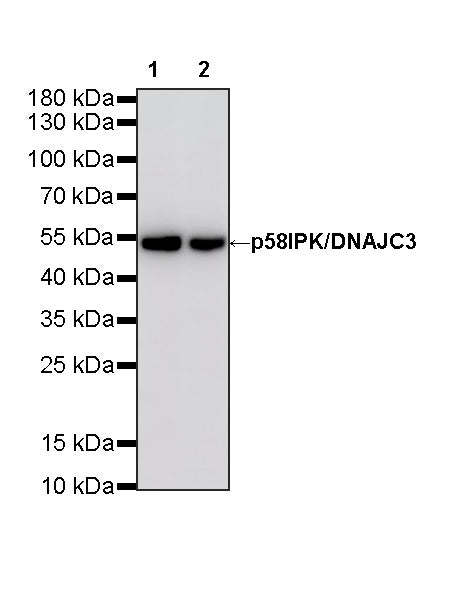 p58IPK/DNAJC3 Recombinant Rabbit mAb (S-4816-205)