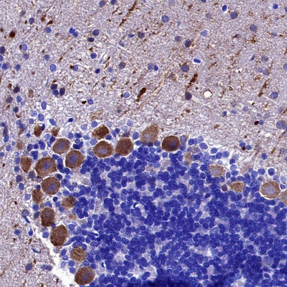 PSD-95 Recombinant Rabbit mAb (S-1518-4)