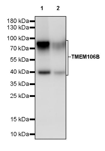 TMEM106B Recombinant Rabbit mAb (S-2362-33)