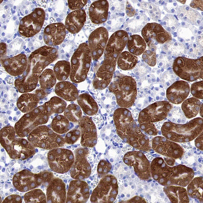 CBS Rabbit Polyclonal Antibody