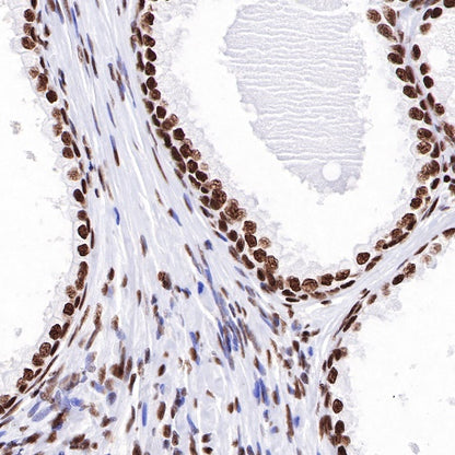 CREB Recombinant Rabbit mAb (S-747-60)