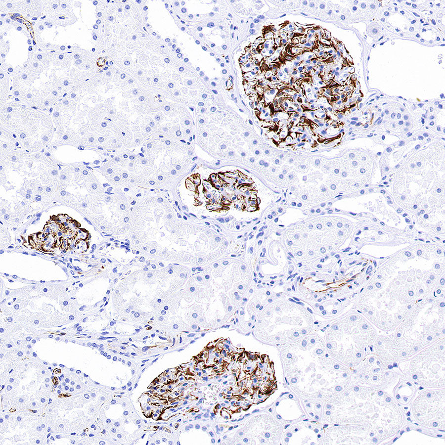 Nestin Recombinant Rabbit mAb (S-3890-112)