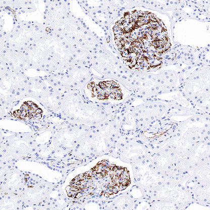 Nestin Recombinant Rabbit mAb (S-3890-112)