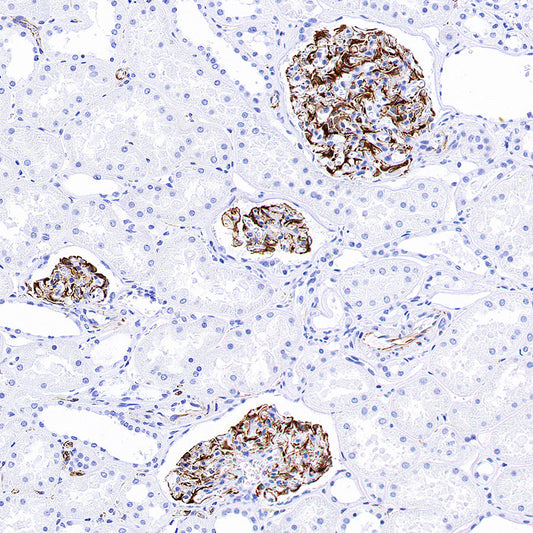 Nestin Recombinant Rabbit mAb (S-3890-112)