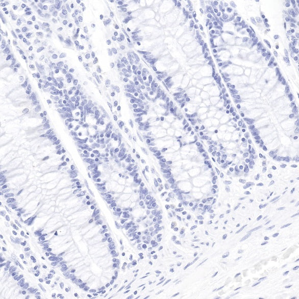 Cytokeratin 7 Recombinant Rabbit mAb (SDT-R028)