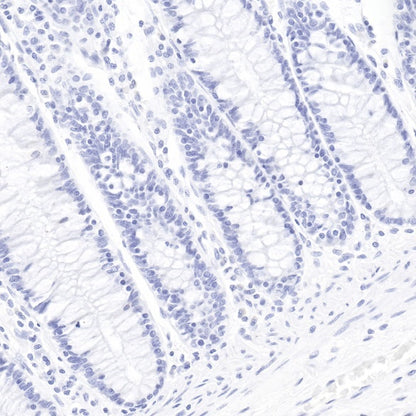 Cytokeratin 7 Recombinant Rabbit mAb (SDT-R028)