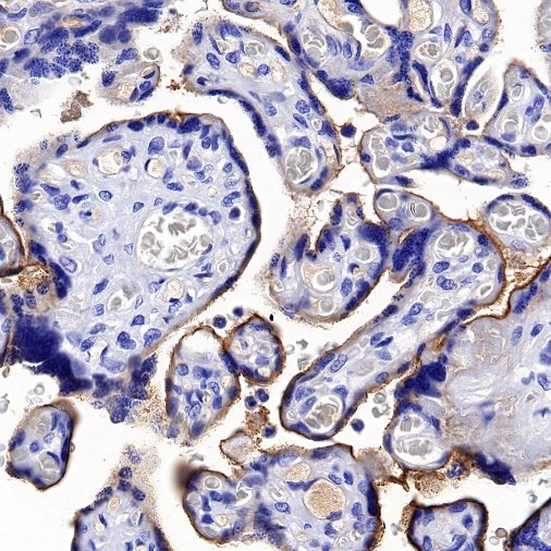 Nectin-4 Recombinant Rabbit mAb (SDT-277-314-1)