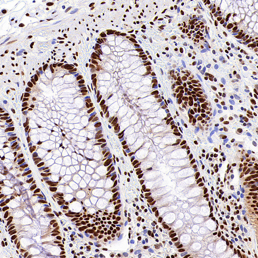 SF3B1 Rabbit Polyclonal Antibody