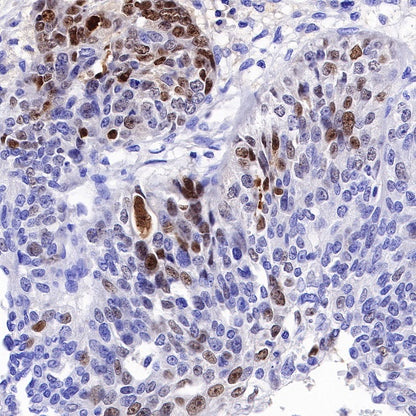 p14ARF Recombinant Rabbit mAb (S-R244)