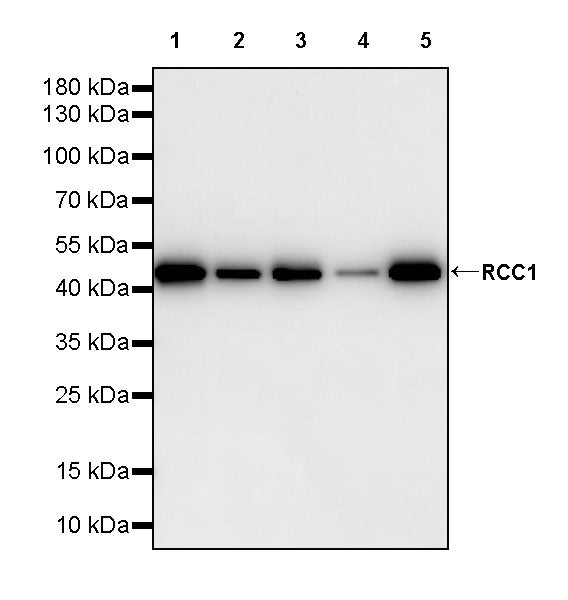 RCC1 Recombinant Rabbit mAb (S-4864)