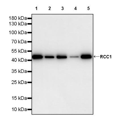 RCC1 Recombinant Rabbit mAb (S-4864)