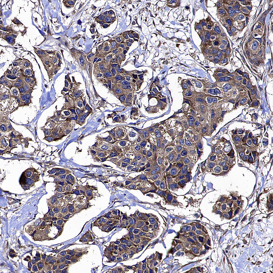 CAPRIN1 Mouse mAb